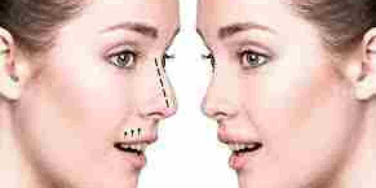 ? Elevate Your Confidence with Expert Rhinoplasty in Dubai