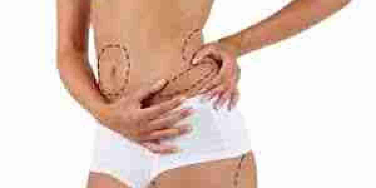 Dubai Liposuction: A New Path to Your Body Goals