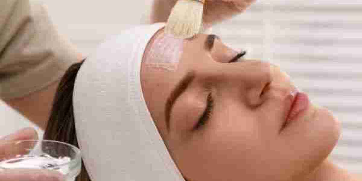 Types of Chemical Peels: A Comprehensive Guide