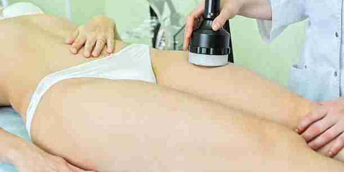 Join the Hair-Free Revolution: Laser Hair Removal in Riyadh