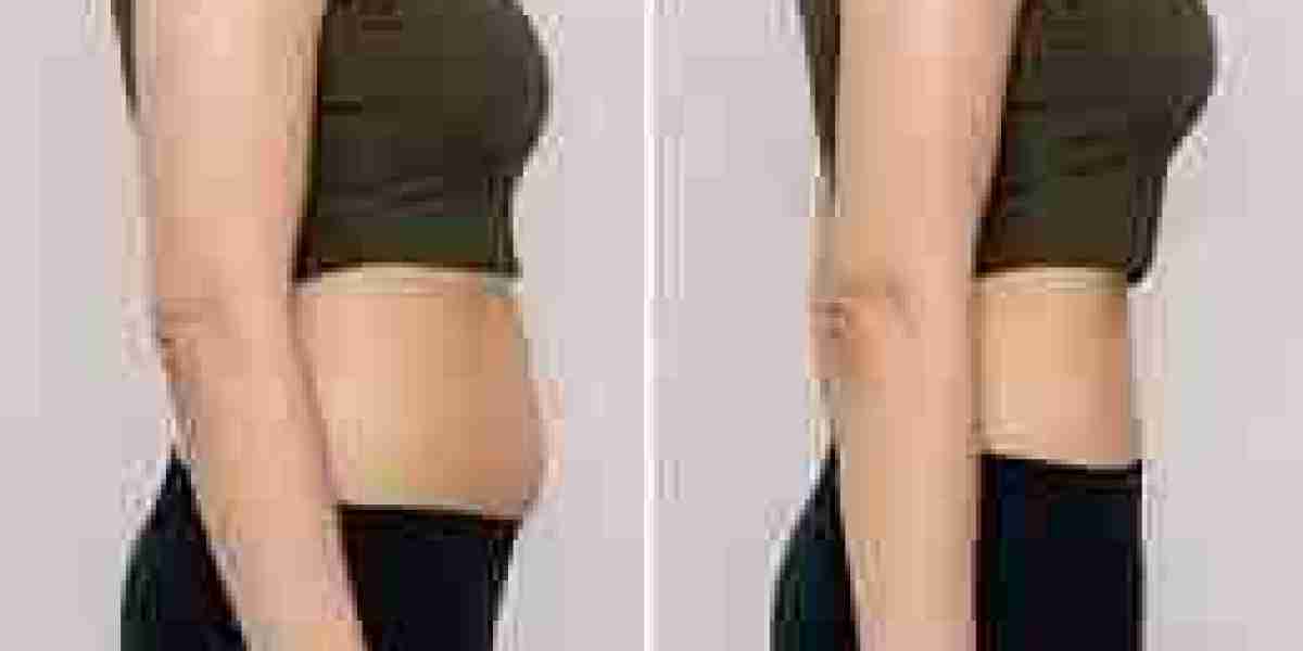 ? Mounjaro Injection: Dubai's Cutting-Edge Weight Loss Revolution!