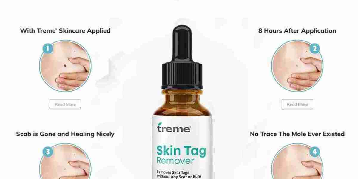 Treme SkinTags, Moles & Wart Remover: Ingredients, Facts, Price & Benefits