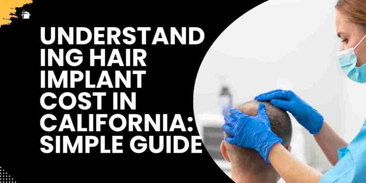 Understanding Hair Implant Cost in California: Simple Guide