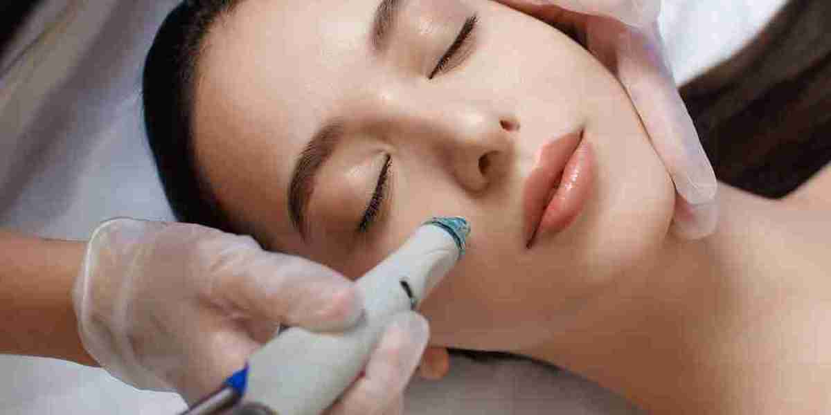 The Ultimate Guide to HydraFacial in Islamabad