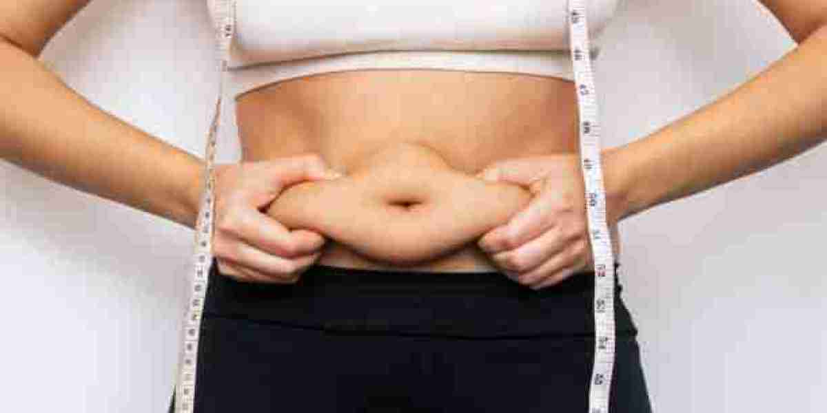 Redefining Beauty: Liposuction Trends in Islamabad