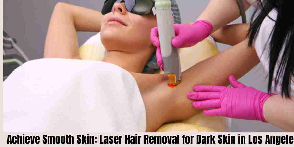 Achieve Smooth Skin: Laser Hair Removal for Dark Skin in Los Angele