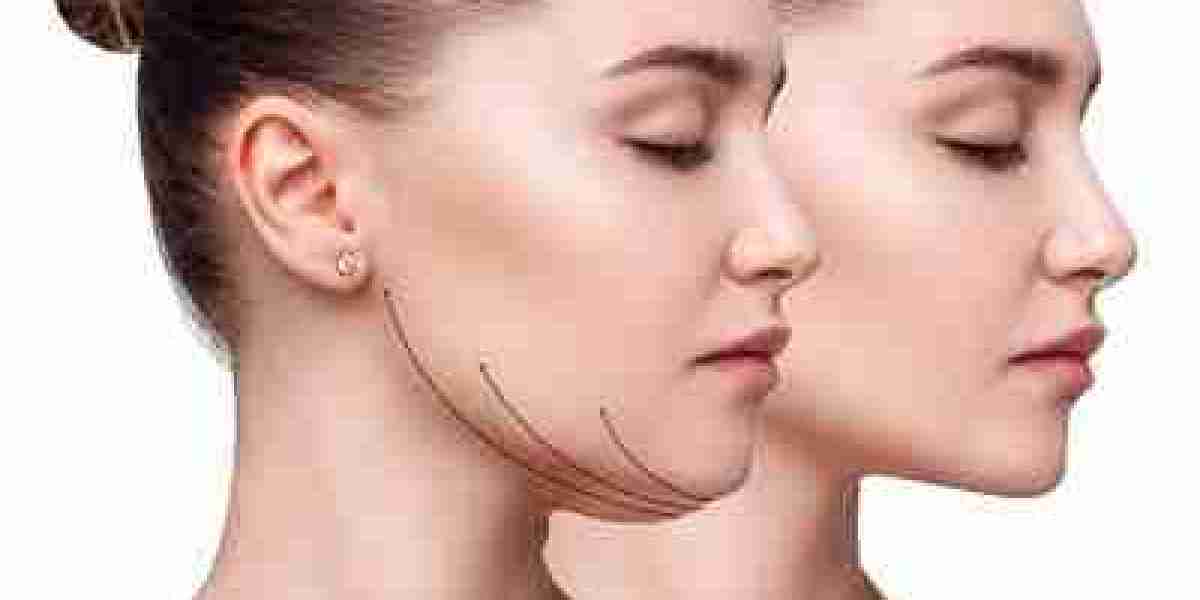 Where to Find Double Chin Removal in Islamabad