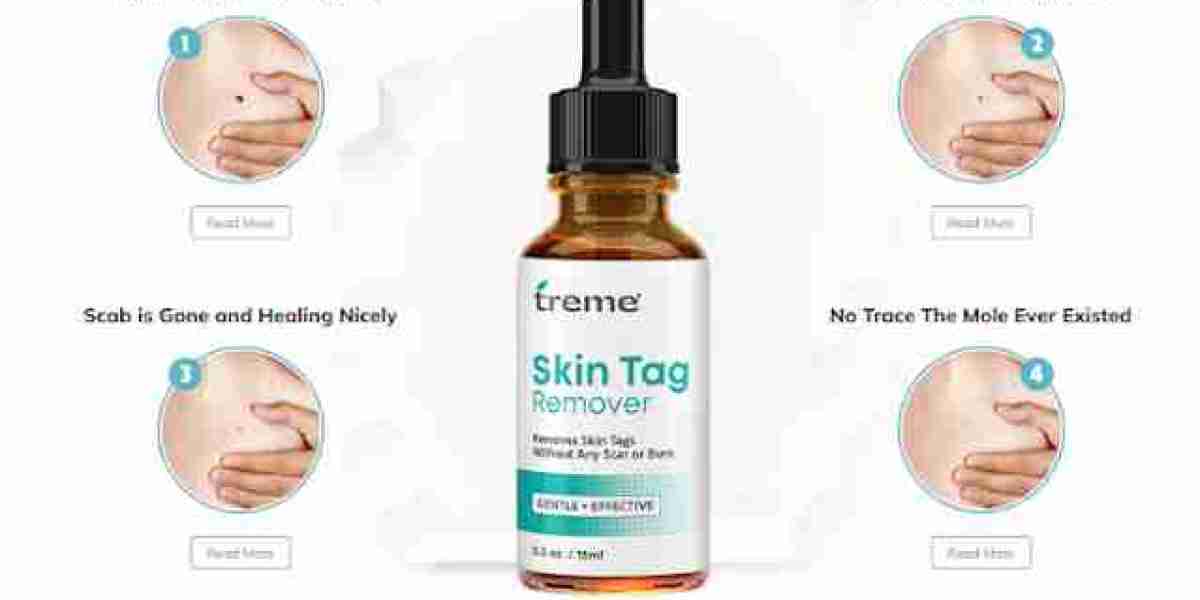 Treme SkinTags, Moles & Wart Remover: Ingredients, Working, Benefits, Where to Buy?