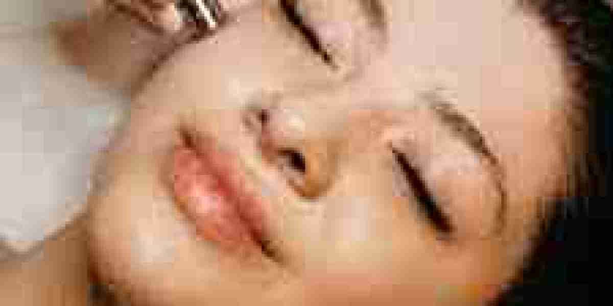 Microneedling: The Secret to Glowing Skin in Islamabad