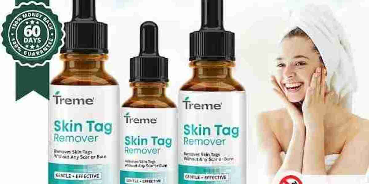 Treme Tag Remover "Official Website": Benefits & Price For Sale