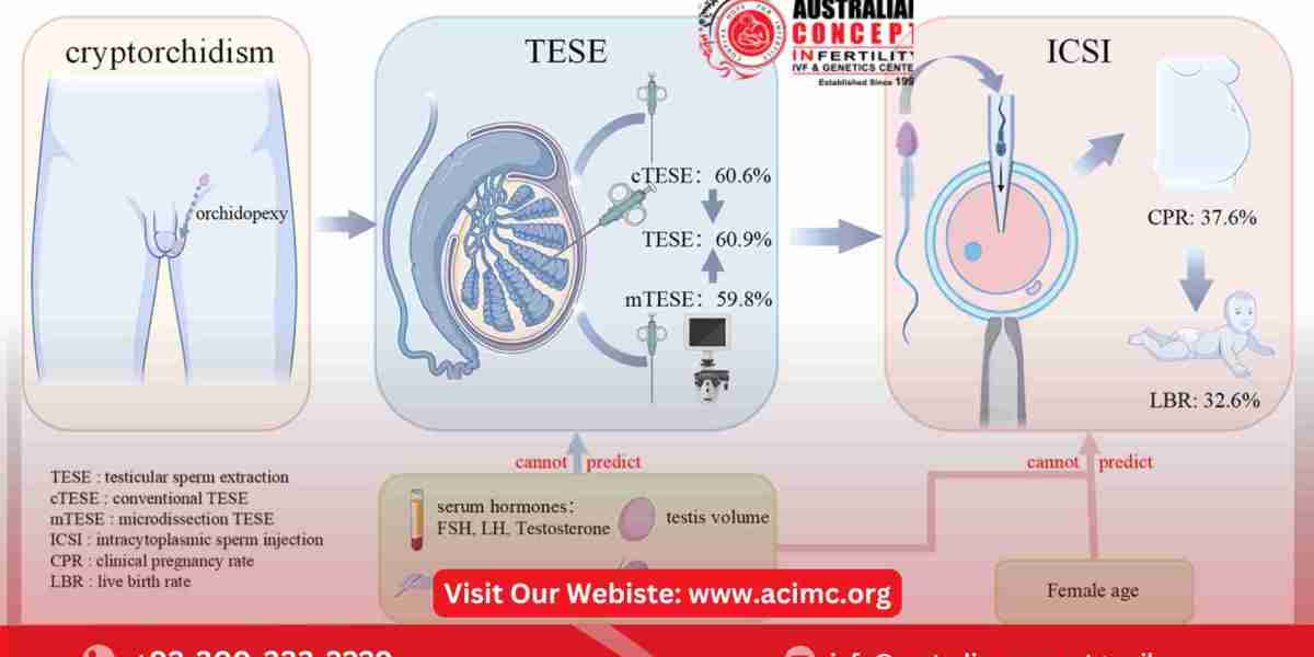 What Are the Latest Advances in Azoospermia Treatment