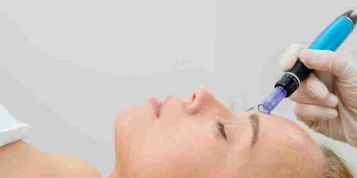 How Dermapen Microneedling Works: Understanding the Technology Behind the Popular Skin Rejuvenation Treatment