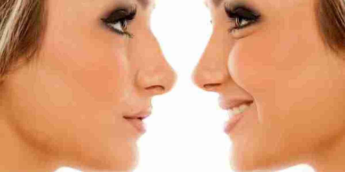 Rhinoplasty for Ethnic Nose Reshaping: Cultural Considerations