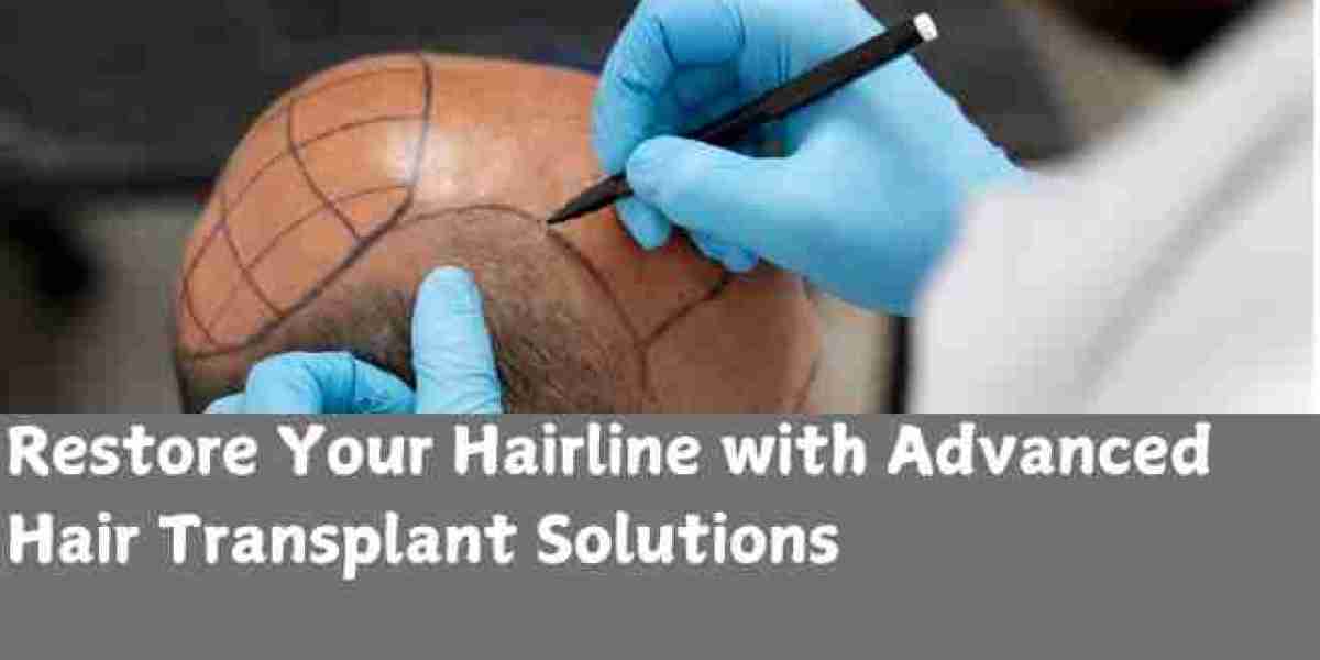 Restore Your Hairline with Advanced Hair Transplant Solutions