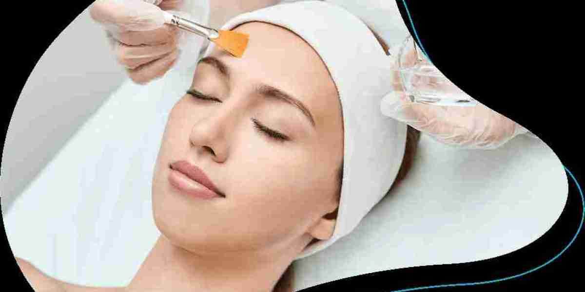 How Chemical Peels Help with Melasma and Uneven Skin Tone