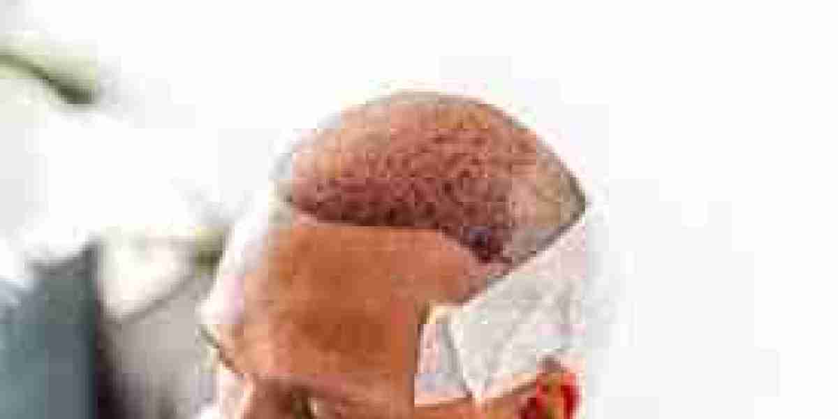 Stem Cell Hair Transplant in Dubai – The Next Big Thing?