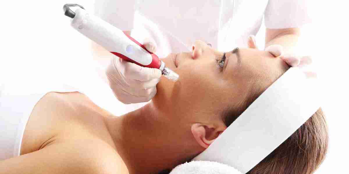 Everything You Need to Know About Microneedling Treatment in Islamabad