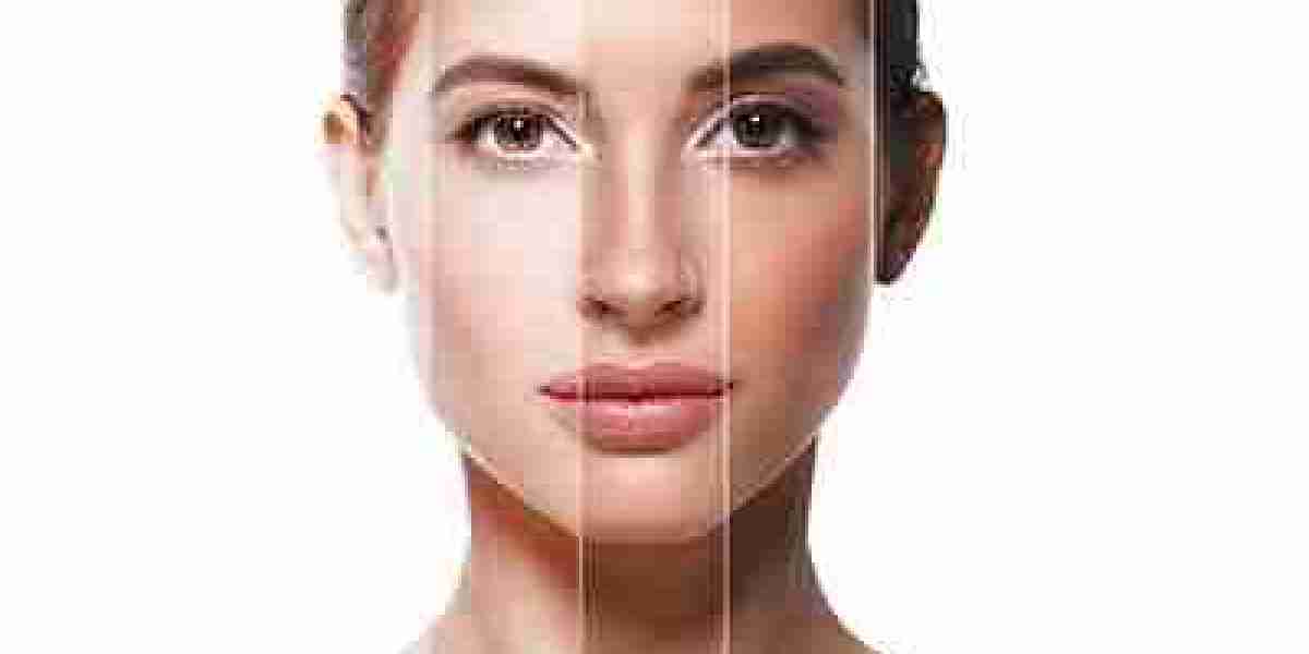 How Often Should You Get Skin Whitening Injections?