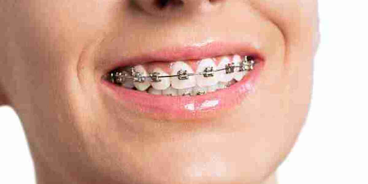 Top-Rated Orthodontists in Riyadh for a Perfect Smile