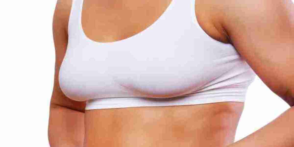 Can a Tummy Tuck Be Reversed If Needed?