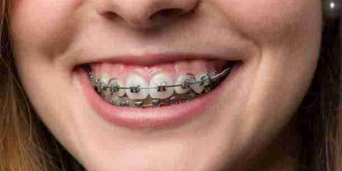 Top-Rated Orthodontists in Riyadh for a Perfect Smile