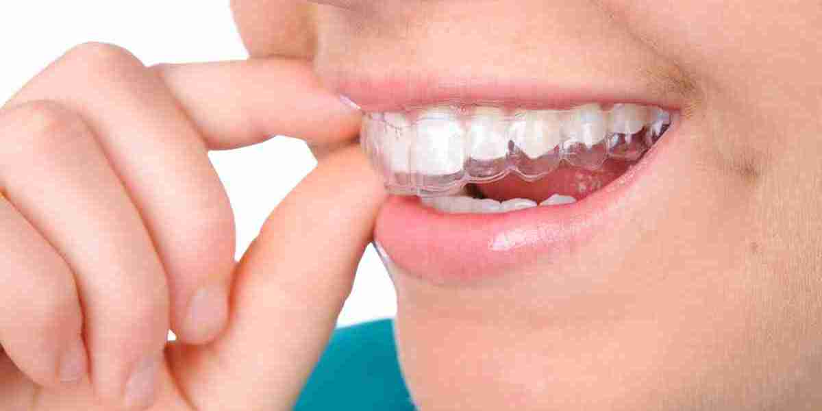 Top Reasons to Straighten Your Teeth in Riyadh Today