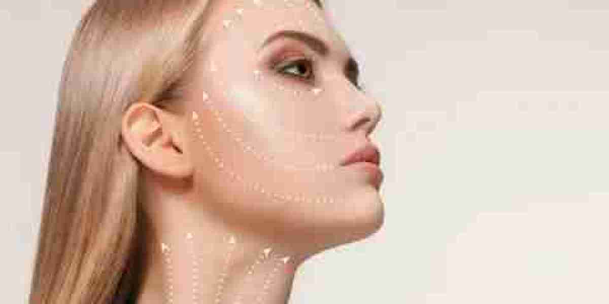 Is Thread Lift Treatment in Islamabad Worth It? A Comprehensive Review