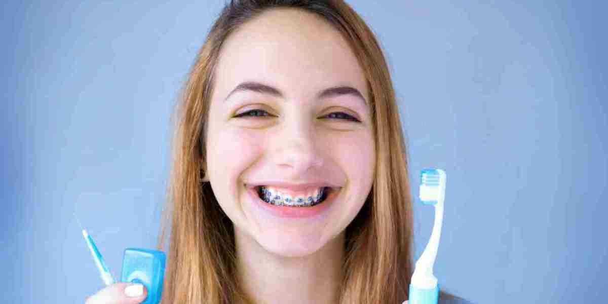 The Cost of Dental Braces in Islamabad: What to Expect