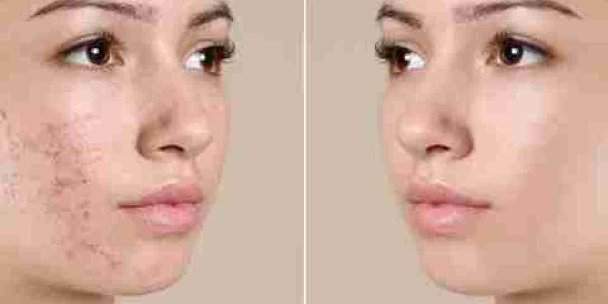Article Picture