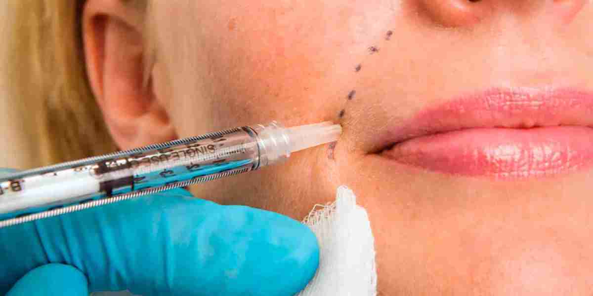 Are Fillers the Secret to a Youthful Glow? Discover How They Transform Your Look