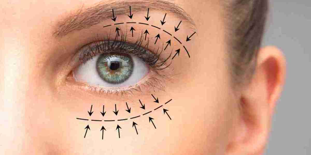 Eyelid Surgery in Islamabad – Brighten and Refresh Your Look