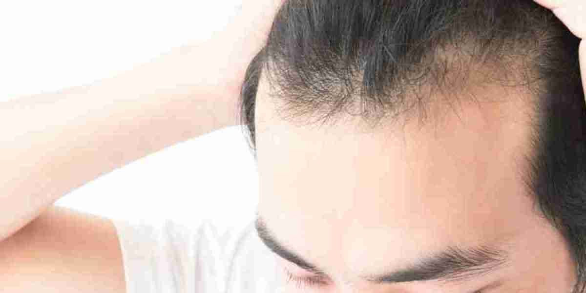 Advanced Stem Cell Hair Therapy in Riyadh
