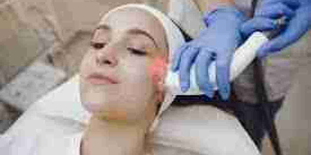 Ultra Glo Resurfacing Facial vs Traditional Facials: Why This Treatment Is Worth It