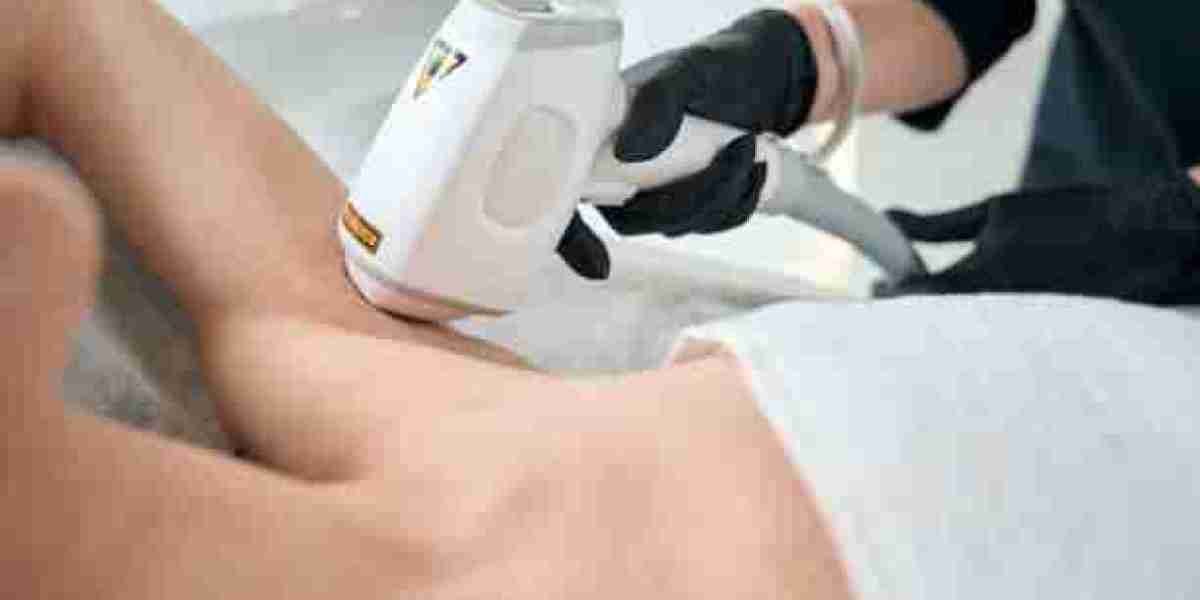 Experience the Luxury of Flawless Skin with Modern Laser Hair Removal in Riyadh