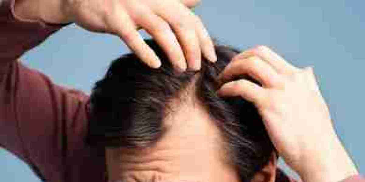 Hair Loss Treatment in Noida: Restore Your Natural Hair Growth
