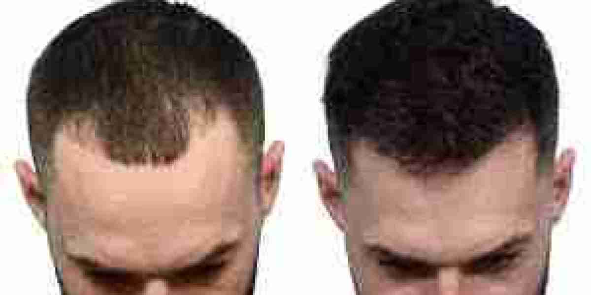 Beyond Generalism: The Growing Imperative of Nursing Specialization and Certification